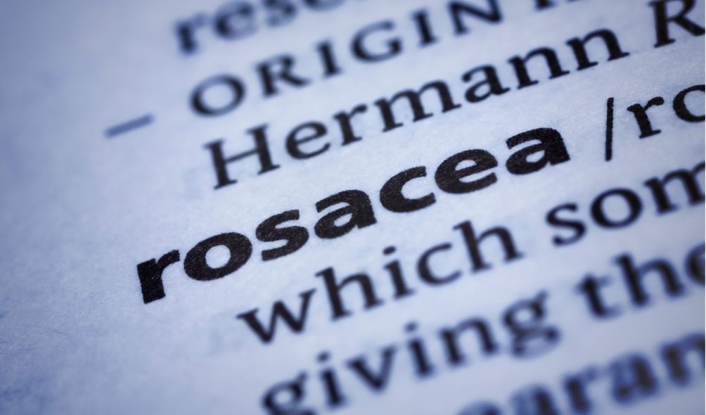 Medical Treatment of Rosacea