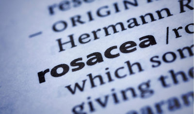 Medical Treatment of Rosacea