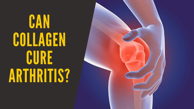 Can Collagen Reduce Joint Pain and Arthritis?