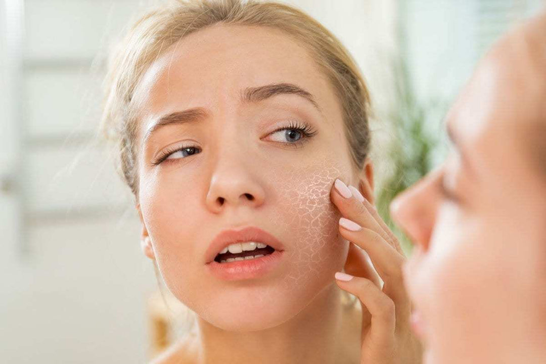 mismo-dry-or-dehydrated-skin-difference|dry-wall-structure-cracked-earth-medium250
