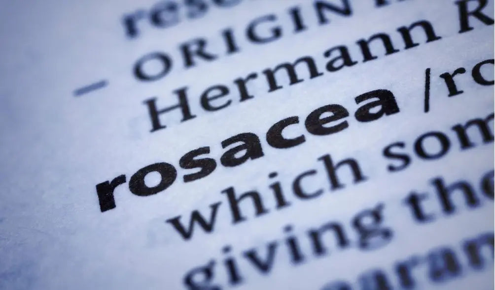 Medical Treatment of Rosacea