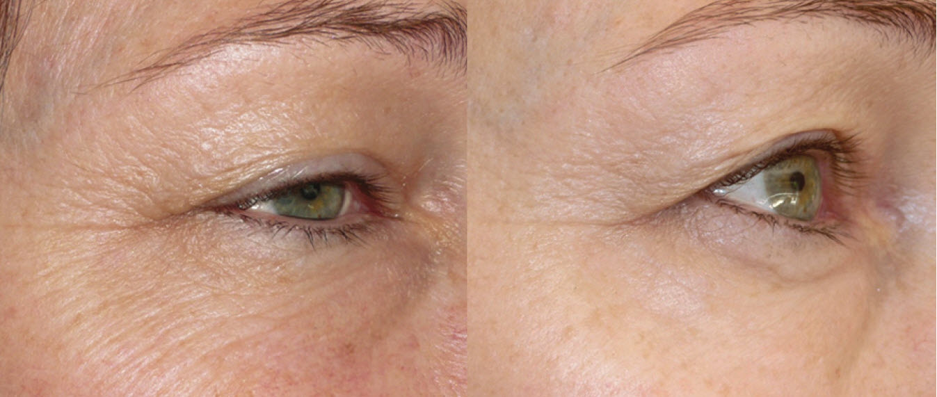 Why This Sulphur Supplement Could Be Your Skin’s New Best