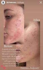MSM Skincare Powerhouse