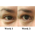 Eye Cream Complex 15ml Skin Care