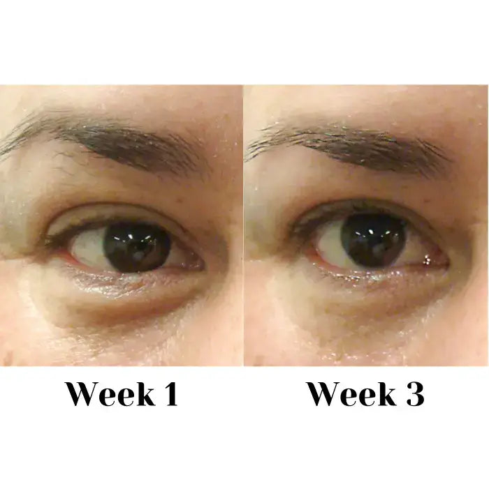 Eye Cream Complex 15ml Skin Care