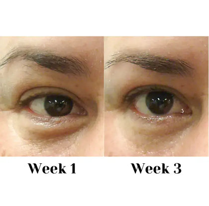 Eye Cream Complex 15ml Skin Care