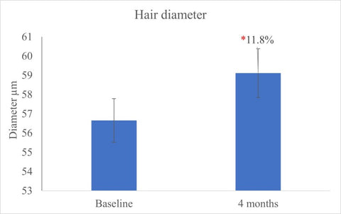MSM Curing Baldness?