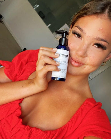 What Acne Sufferers Should Avoid